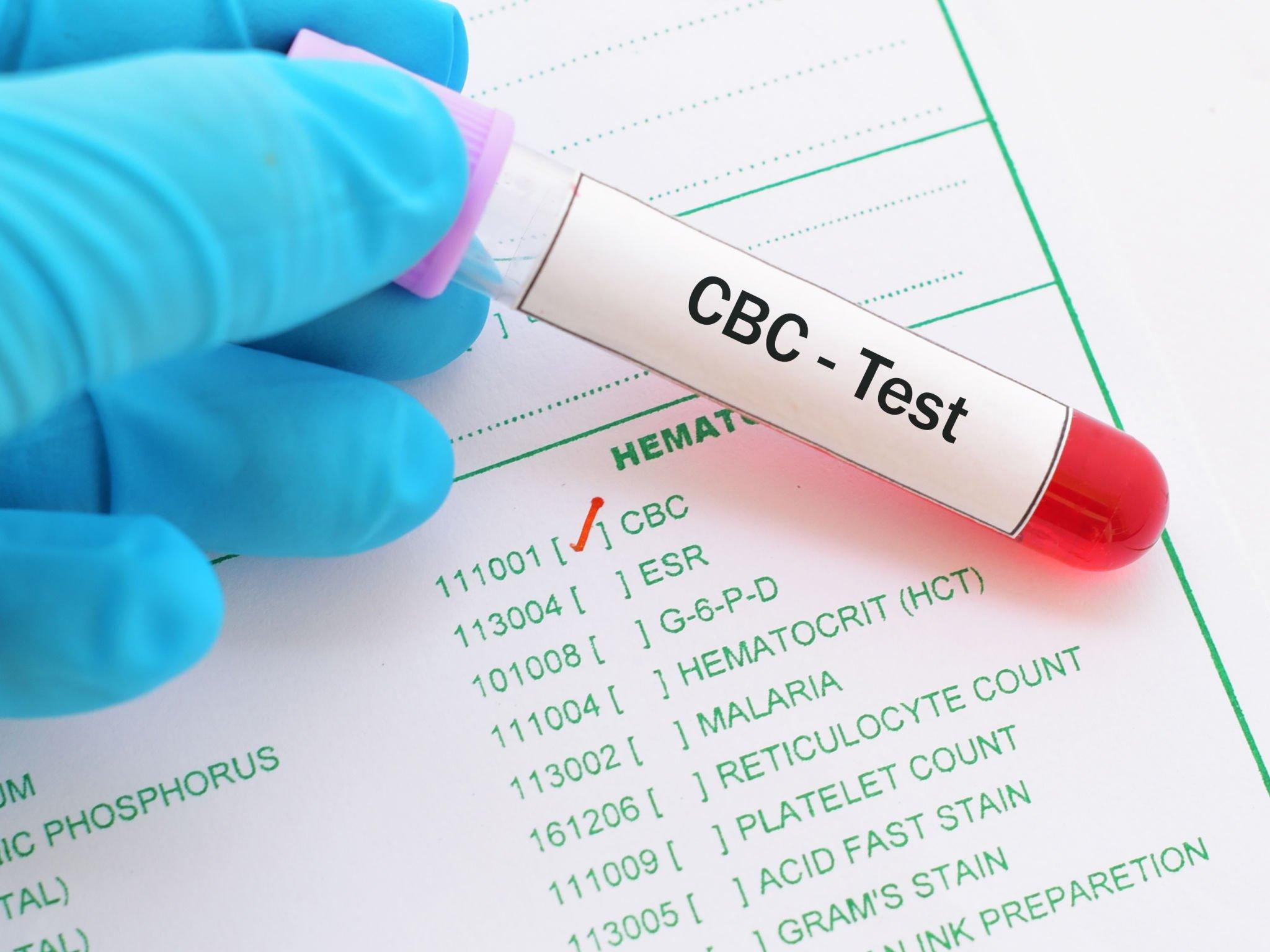 Image for CBC Blood Test
