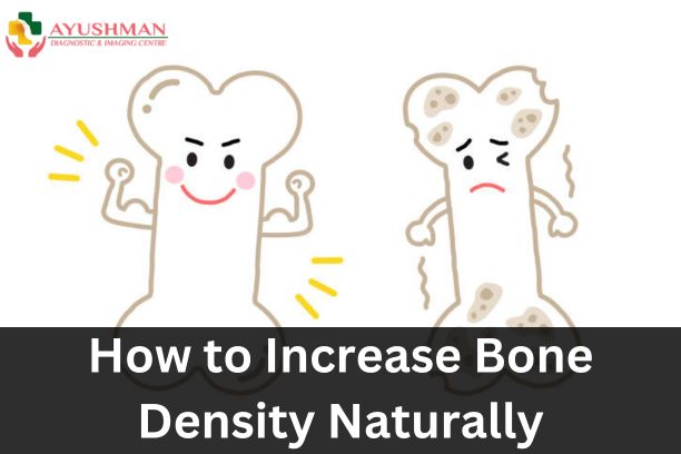 How to Increase Bone Density Naturally