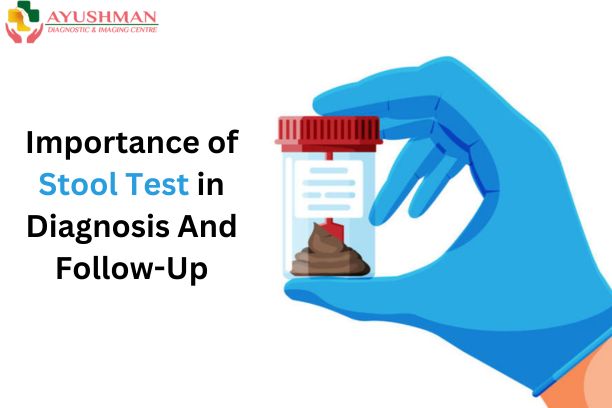 The Importance of Stool Test in Diagnosis And Follow-Up