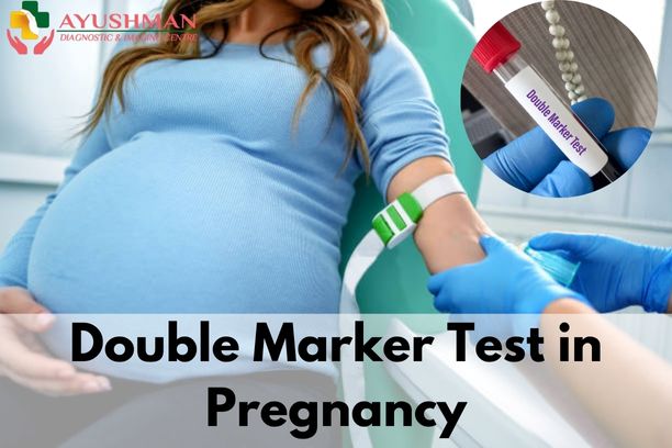Double Marker Test in Pregnancy