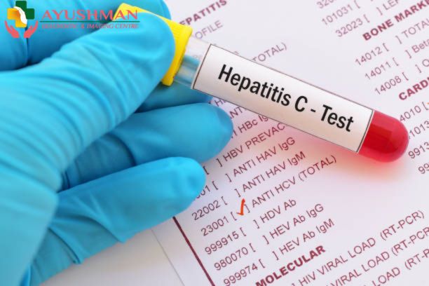 HCV test in Dwarka