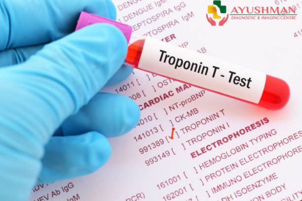 Troponin T Test