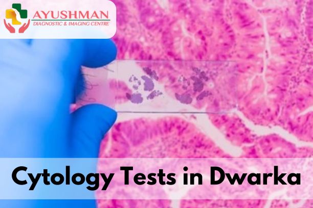Cytology Tests in Dwarka