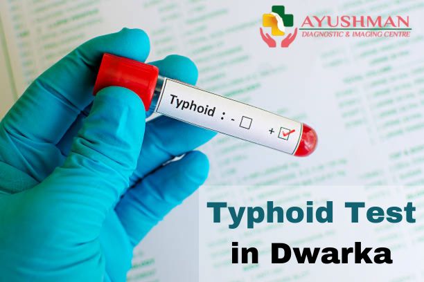 Typhoid Test in Dwarka