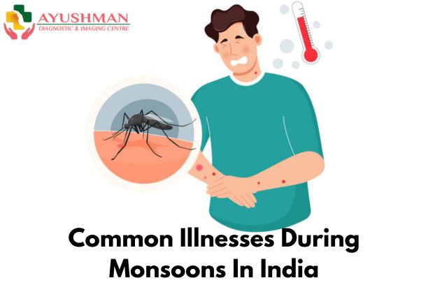 Common Illnesses During Monsoons In India